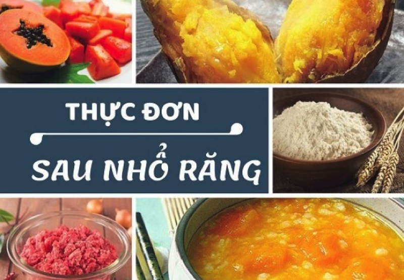 nha-khoa-nho-rang-khon-chat-luong-Nha-Trang
