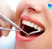 Nhổ 2 răng khôn cùng lúc có sao không?