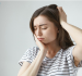 Khi nào cần phải nhổ răng khôn?