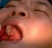 Người trưởng thành nhổ răng có làm giảm tuổi thọ không?